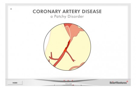 HeartVentures Coronary Artery Disease Animated Slide